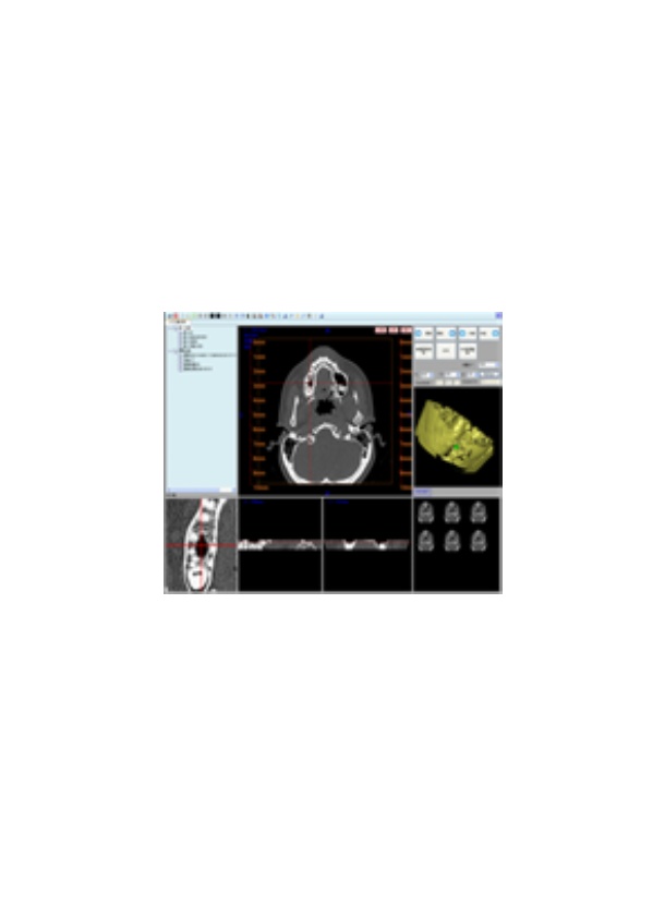 DicomStrong 3DWorkStation