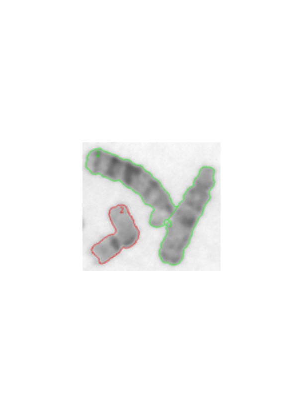 ImageStation染色体分離